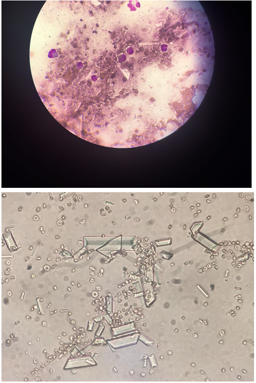 猫膀胱炎尿血但是精神正常,猫膀胱炎尿不出来怎么办