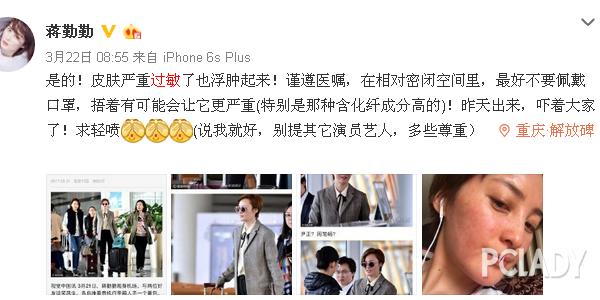 紫外线过敏舒淇,舒淇敏感肌怎么自救