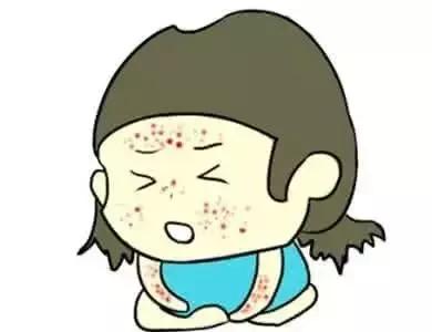 小儿大腿两侧湿疹 (小儿皮肤干性湿疹)