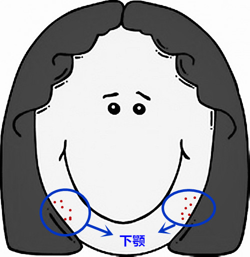 超全面面部痘痘分析图文，了解身体状况！