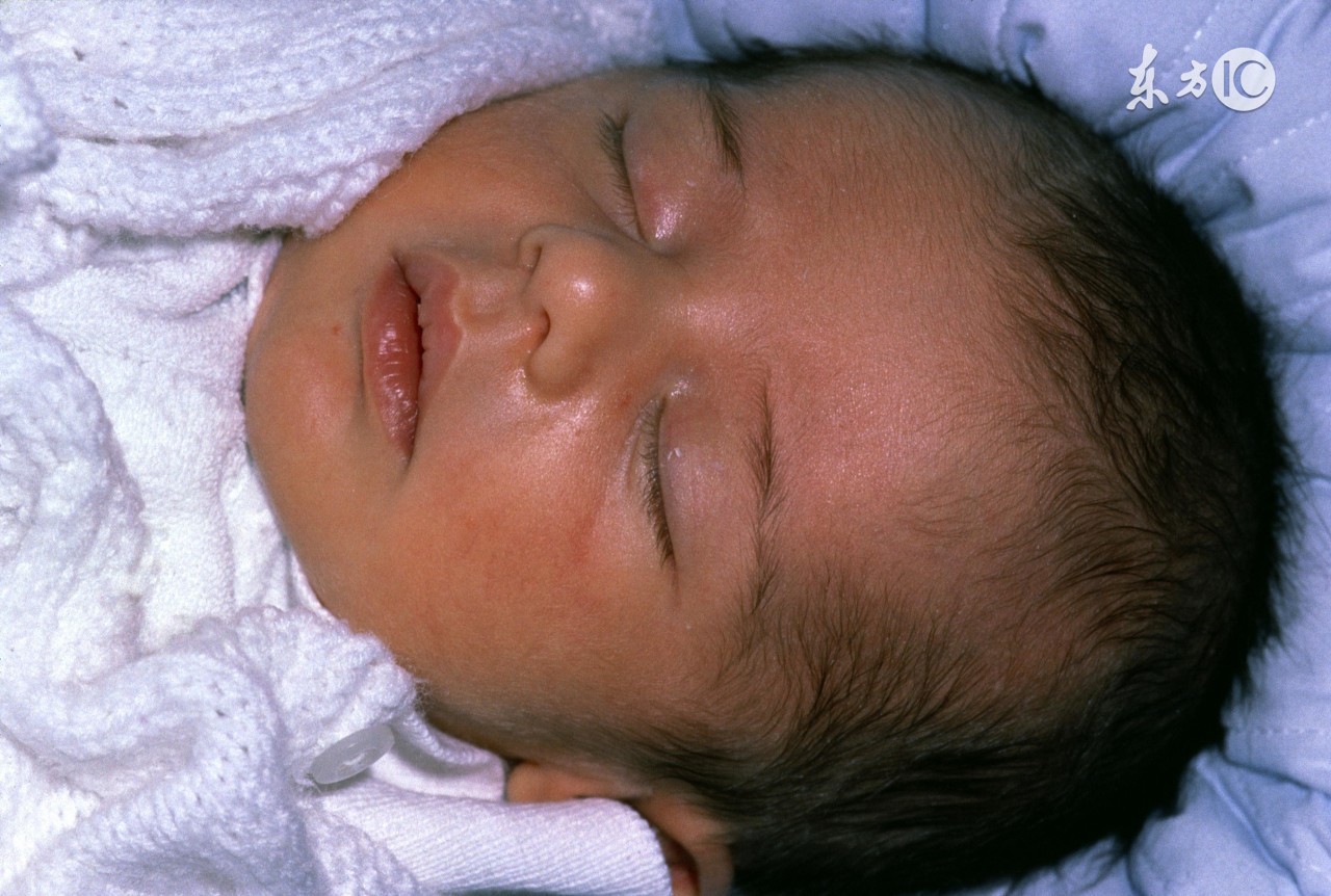 新生儿黄疸吃药后拉什么样的便便,新生儿黄疸吃药还是抹药