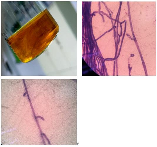 猫癣十几处,猫癣症状治疗多少钱