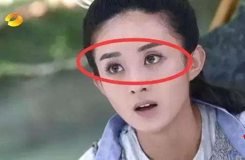 拯救三眼皮的方法,术后出现三眼皮算手术失败吗