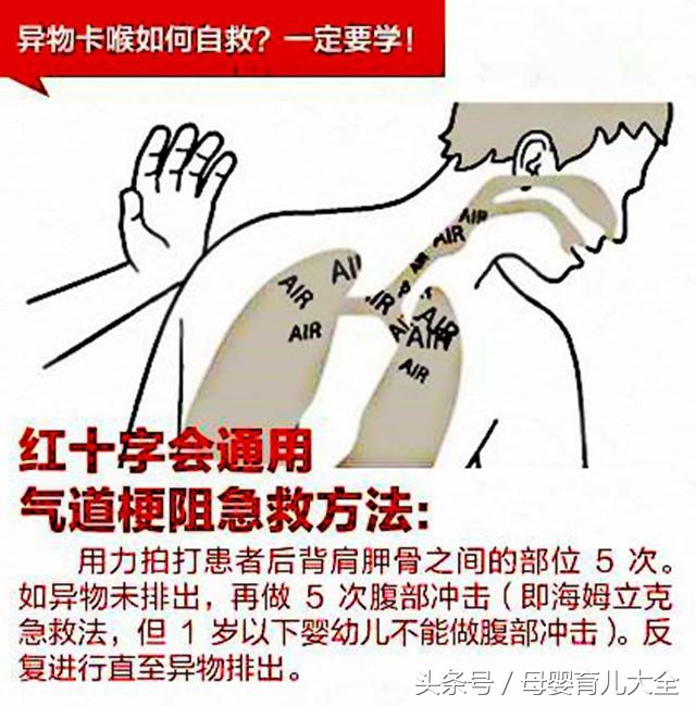 宝宝误吞异物该如何自救,儿童吞食异物急救视频