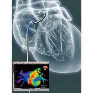 房颤消融能根治房颤吗,得了房颤怎么才能根治