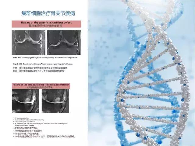 巨噬细胞衰老骨质疏松,成骨细胞会衰老吗