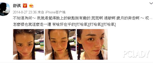 紫外线过敏舒淇,舒淇敏感肌怎么自救