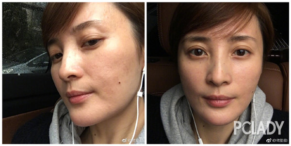 紫外线过敏舒淇,舒淇敏感肌怎么自救