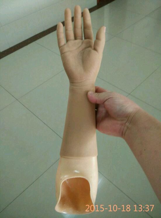 截肢后戴假肢老是疼怎么处理,截肢病人关注事项