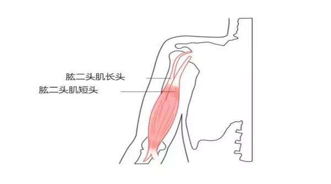 打篮球导致胳膊上方疼痛怎么办,打篮球受伤后怎么恢复自己投篮