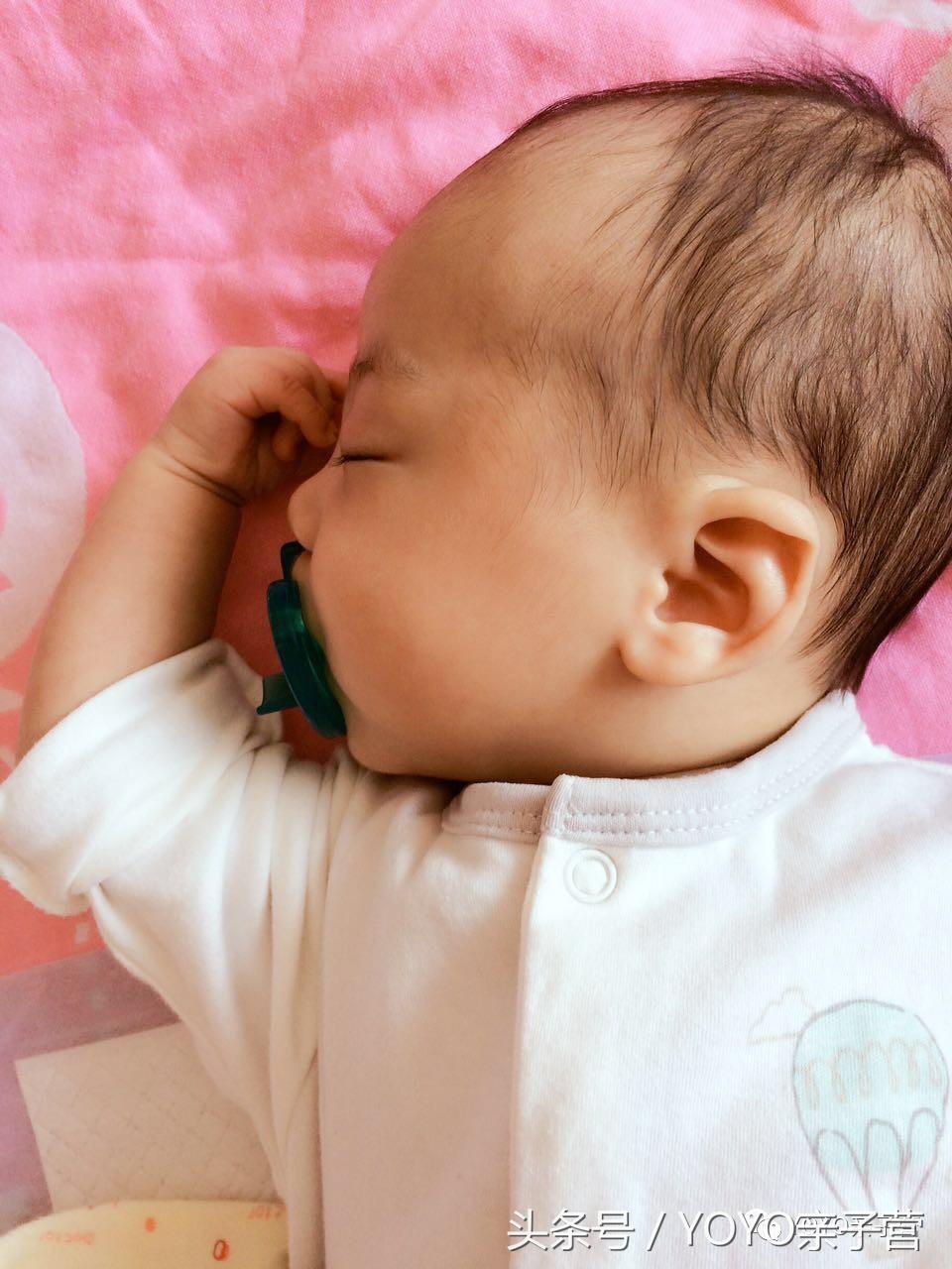 在树宝N次湿疹之后，我总结了这份战“痘”清单送给新手妈妈