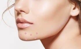 下巴痘痘反复长不停如何正确祛痘,下巴老是长痘痘怎么调理身体啊