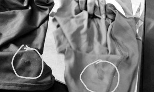 被老鼠屎污染的衣服怎么消毒,老鼠污染过的物品怎样消毒