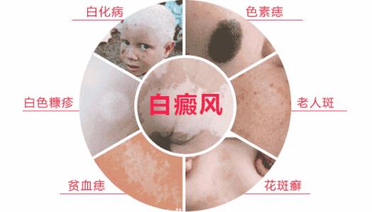 专家剖析白癜风的病因,白癜风患者查明病因的重要性