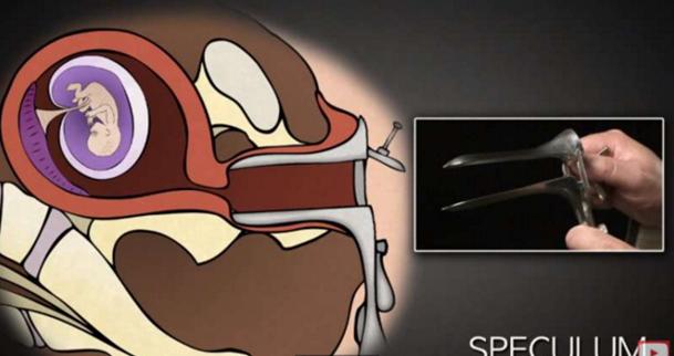 堕胎手术详细流程,女性堕胎手术的可怕真相