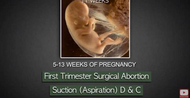 堕胎手术详细流程,女性堕胎手术的可怕真相