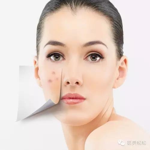 脸敏感泛红冒痘怎么解决 (春季脸干爆皮起痘)