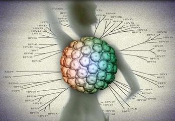 谈宫颈癌的致病“元凶”——HPV