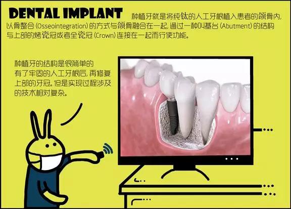 种植牙科普漫画,种植牙漫画素材