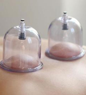 腹部拔罐能治疗拉肚子吗,腹泻拔罐穴位