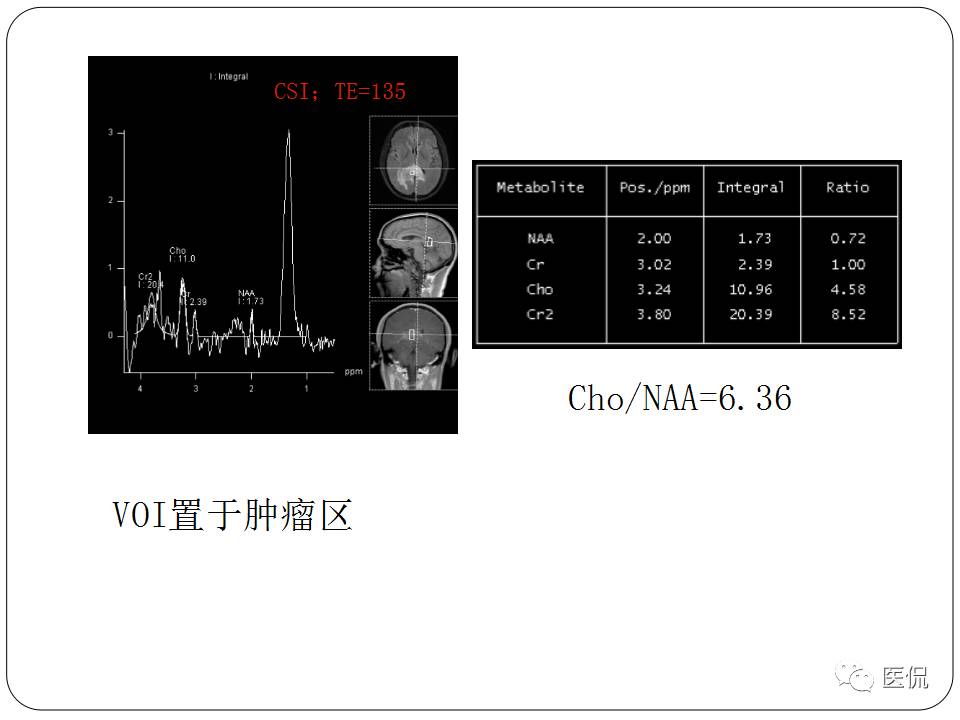 神经系统解剖ppt课件,神经内科课件ppt