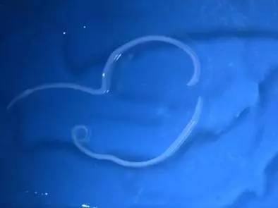 我们日常吃的三文鱼有寄生虫吗,所有的三文鱼都有寄生虫吗