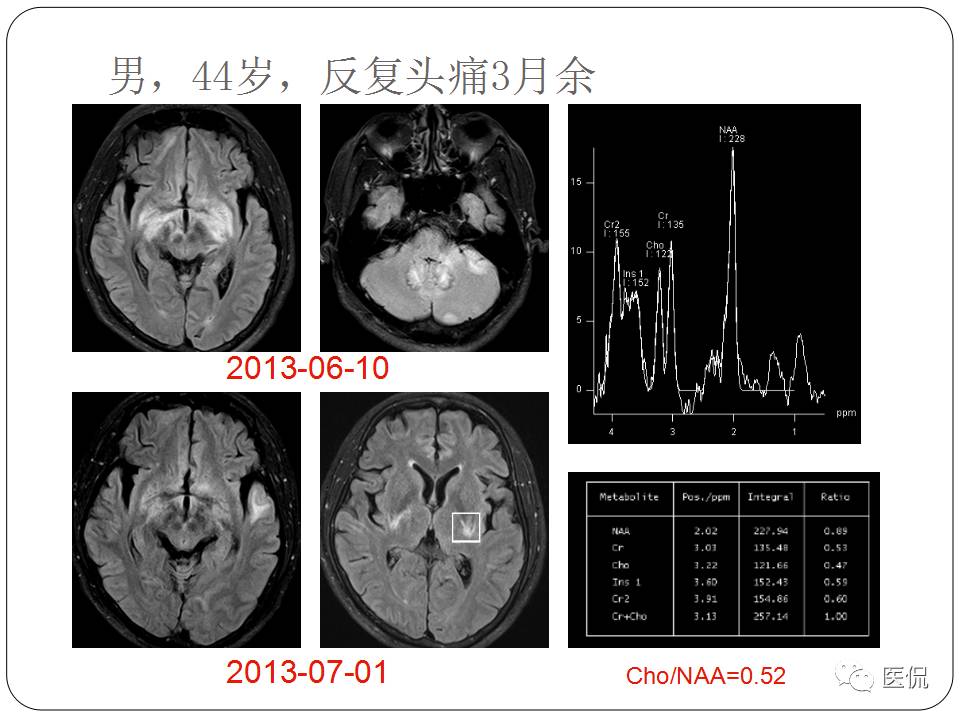神经系统解剖ppt课件,神经内科课件ppt