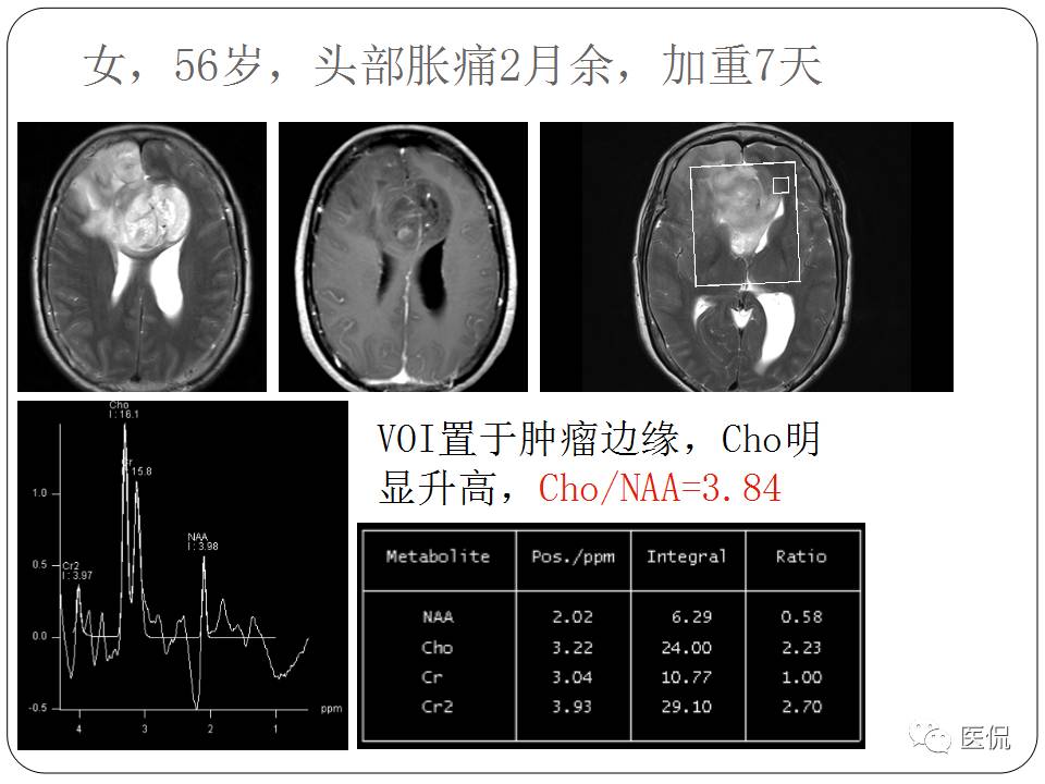神经系统解剖ppt课件,神经内科课件ppt