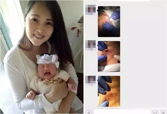 好险！产后感染差点失去子宫……看剖宫产后如何护理伤口？