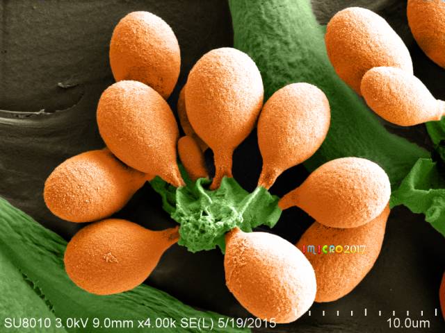 微观星球显微镜下的奇妙世界,显微镜下的奇妙世界视频