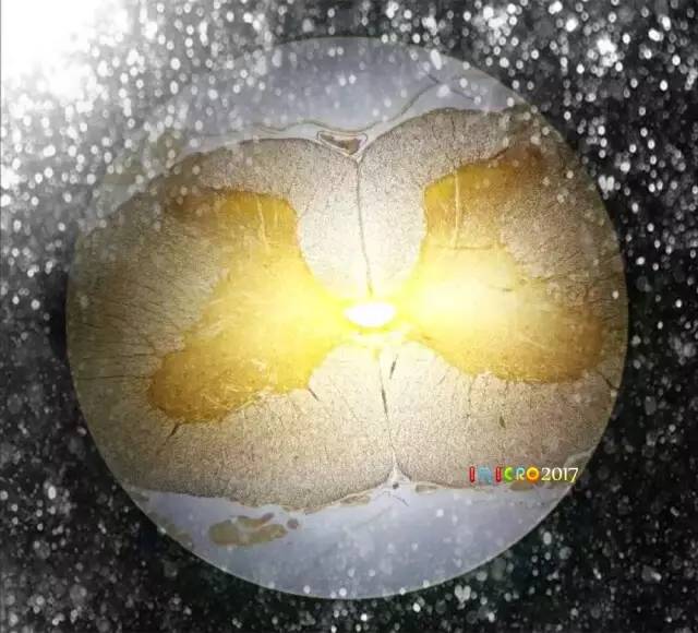 微观星球显微镜下的奇妙世界,显微镜下的奇妙世界视频