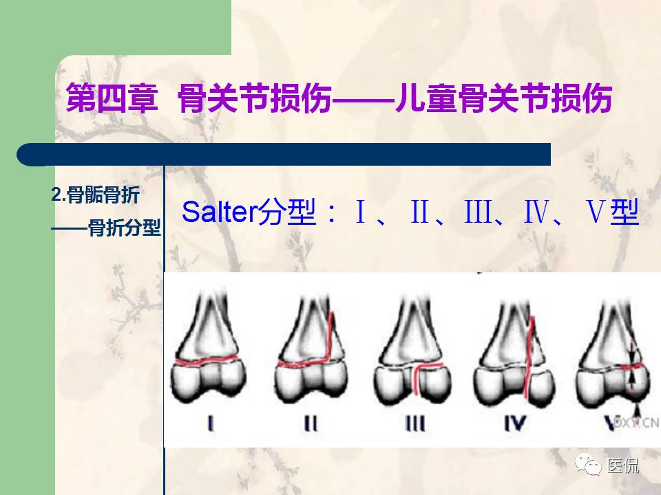 骨关节创伤x线诊断图谱,骨关节损伤x线图
