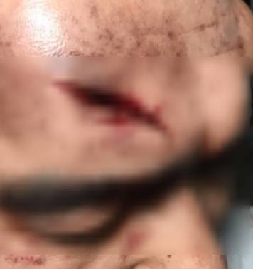 愤怒！安顺一医生被多名男子*力暴**围殴！头部遭踩踏、飞踹……监控记录全过程