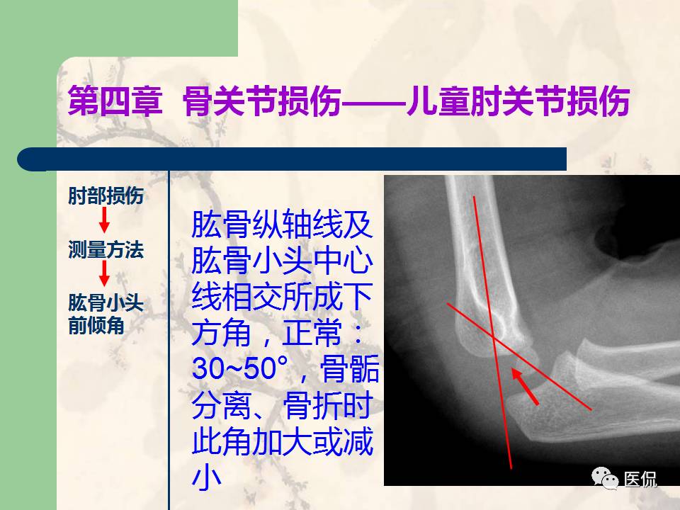 骨关节创伤x线诊断图谱,骨关节损伤x线图
