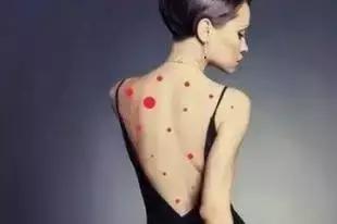 背部痘痘如何快速解决,背部痘痘反复长不停如何正确祛痘