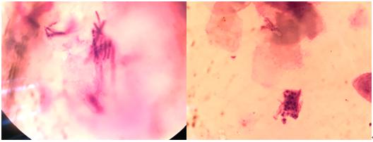 猫癣十几处,猫癣症状治疗多少钱