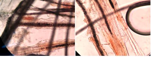 猫癣十几处,猫癣症状治疗多少钱