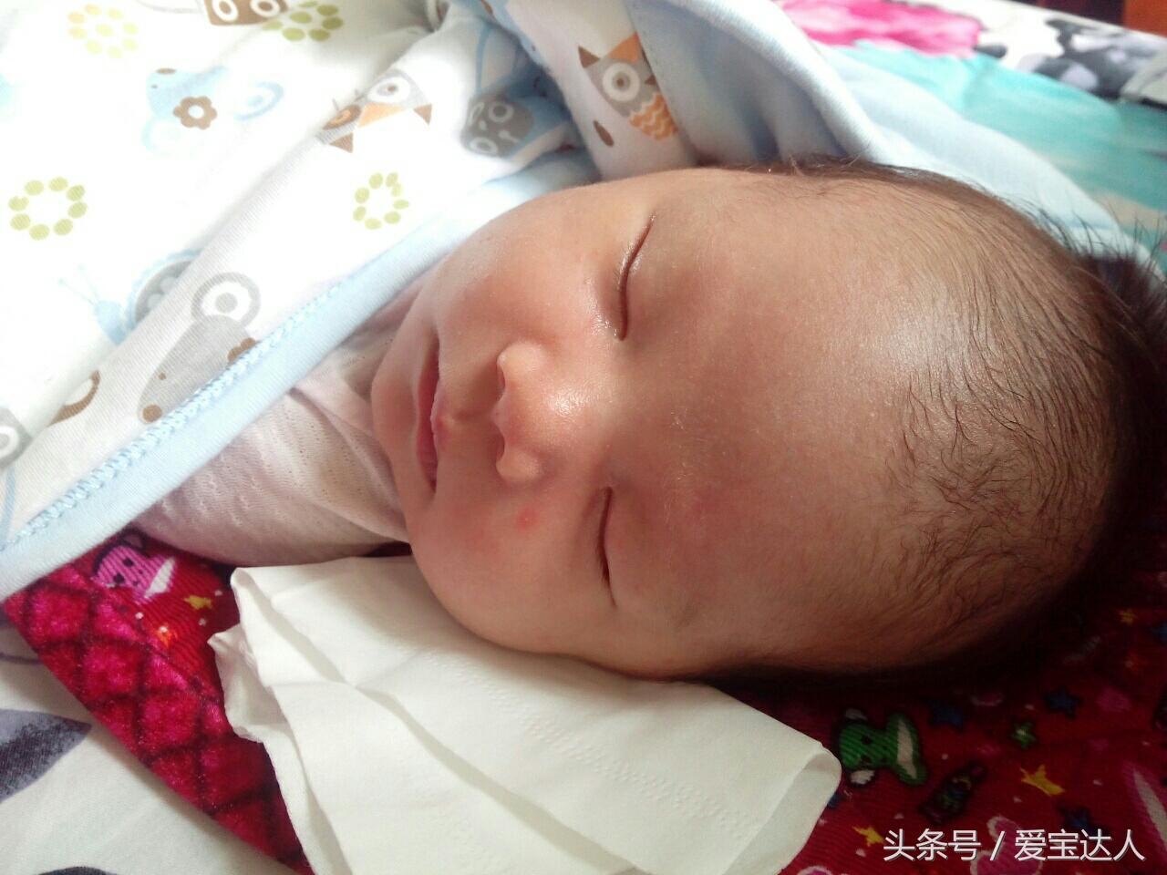 高温天气宝宝淹脖子,宝宝汗淹了脖子怎么办