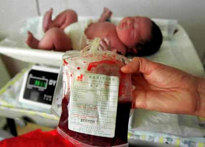 白血病用婴儿的脐带血怎么治,绕开白血病的最佳方法