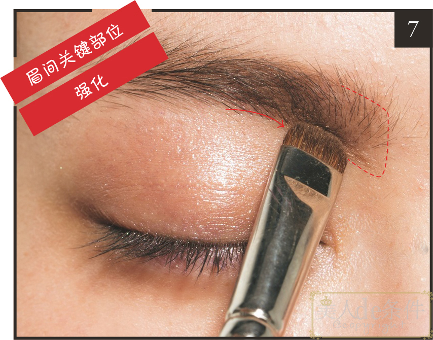 眉头太低打玻尿酸怎么能提上去,经常皱眉要不要打玻尿酸