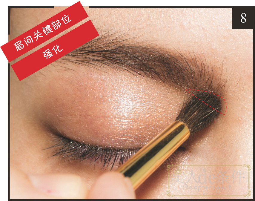 眉头太低打玻尿酸怎么能提上去,经常皱眉要不要打玻尿酸