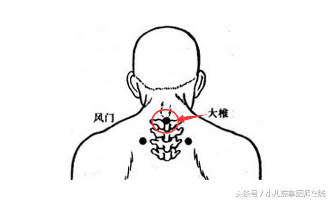 颈椎病三伏贴贴哪几个穴位,膝盖疼贴三伏贴贴哪个穴位最好
