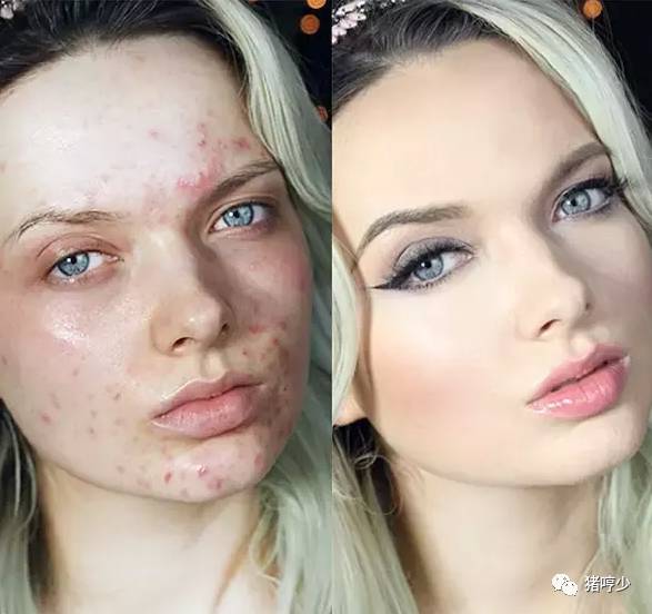 明星皮肤真的不长痘吗,脸上不长痘