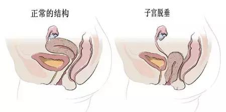 满月发汗的亲身经历,满月发汗真的有必要去做吗