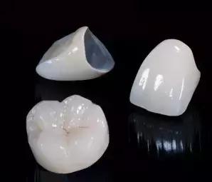 虫牙必须要做烤瓷牙吗,虫牙拔了之后不种植牙会咋样