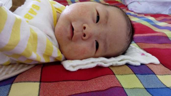 宝宝脸上出现密密麻麻的小疙瘩,宝宝脸上起了疙瘩跟癣似的