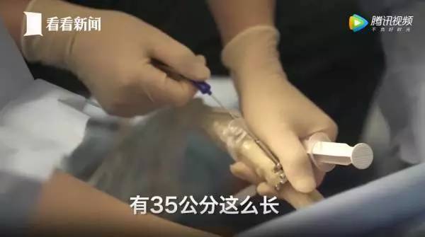 捐卵，被明码标价的青春｜关于捐卵应该知道的科普