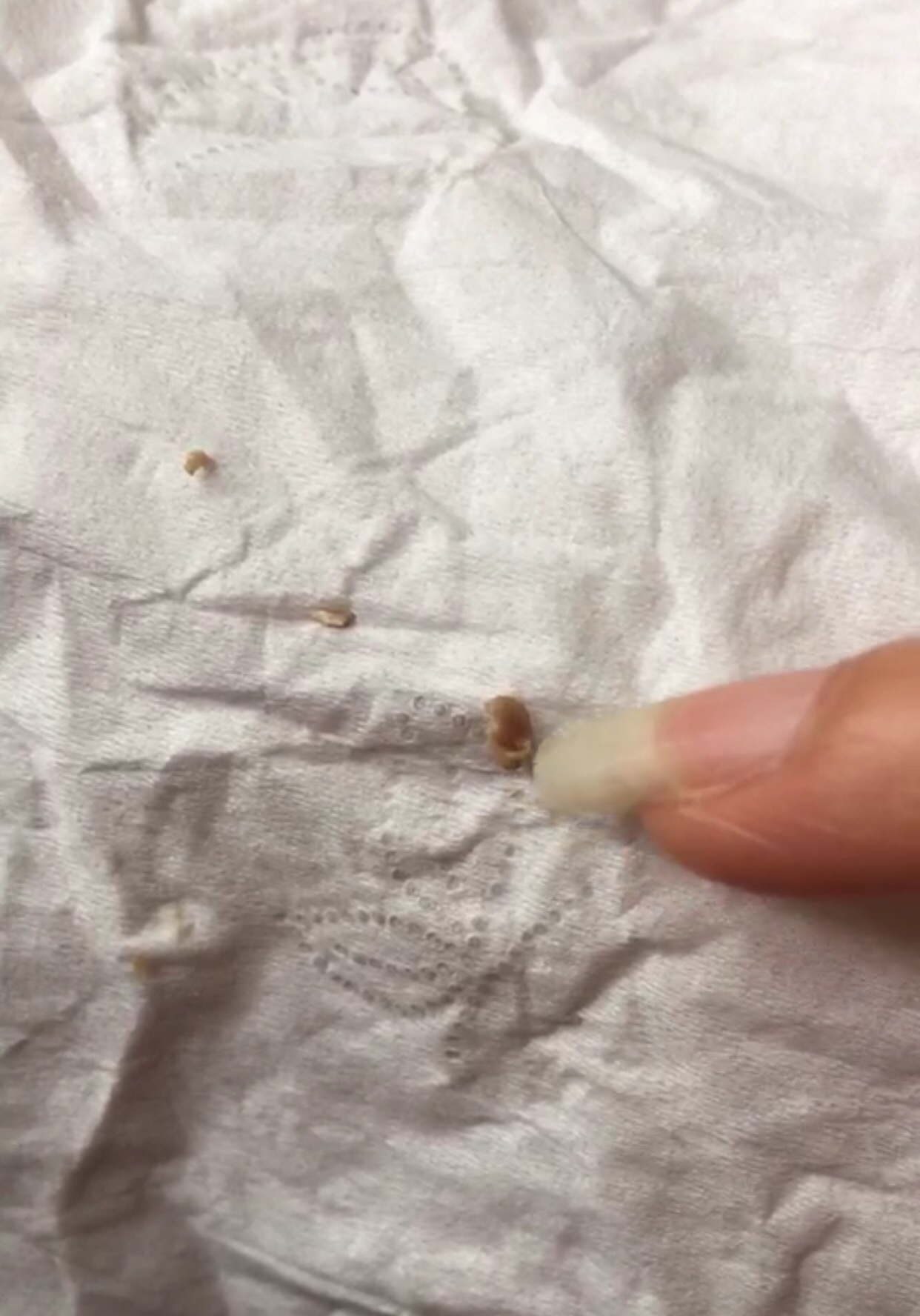 老猫肾结石,老猫得肾病