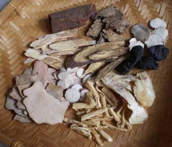 爱出汗体质的人如何防止出汗,经常出汗的人需要关注什么