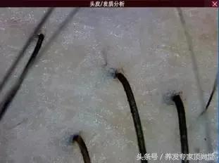 头发少适合什么发型,头发少怎么扎好看